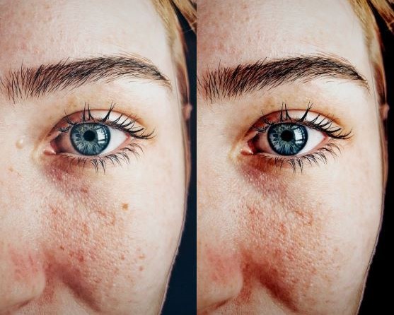 Digitale Schönheitskur